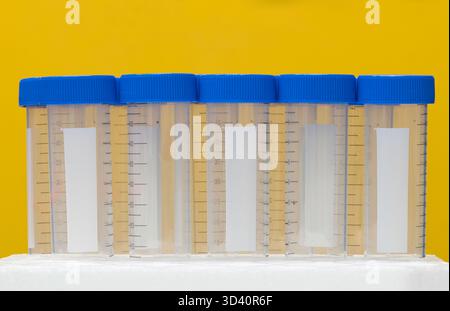 Plastic test tubes empty bottle vials milliliter measurement with caps on yellow background. Stock Photo