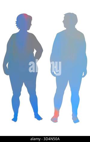 Obese man. There are three types of obesity: android obesity abdomen ...