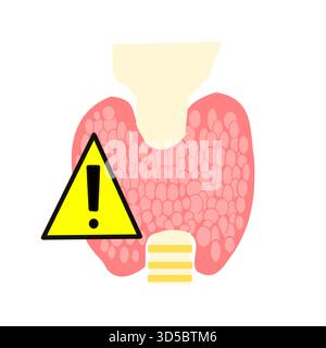 thyroid glands in danger symbol yellow warning symbol on thyroid function hypothyroidism hyperthyroidism Stock Vector