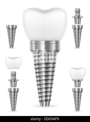 tooth metal human implant cartoon stock vector illustration isolated on white background Stock Vector