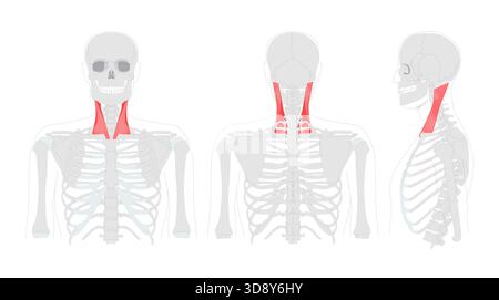 Neck Lateral Rotation Muscles