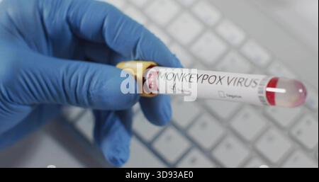 Holding blue-nitrile glove showing MONKEYPOX blood tube at lab desk, yellow cap, checked positive Stock Photo