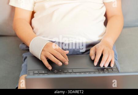 Cropped shot man with a wrist bandage is sitting on sofa and using laptop. Recovery after incident. Remote communication, distance learning, technolog Stock Photo