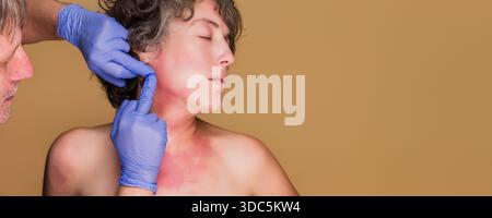Doctor examining woman with eczema skin rash Stock Photo