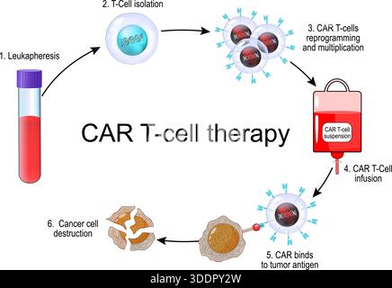 CAR T-cell therapy. Cancer immunotherapy. CAR-T cell for killing of tumor. Personalized medicine. Vector illustration Stock Vector
