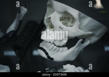 skull prototype with dark titanium implants and mesh reinforcements used in orthopedic and maxillofacial implant  Stock Photo