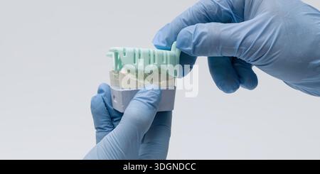 Close-up of gloved hands adjusting a dental bite registration mold on a plaster tooth model for prosthetic fitting or alignment. Stock Photo