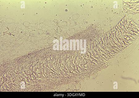 A photomicrograph shows an endothrix, a dermatophytic fungal infection ...