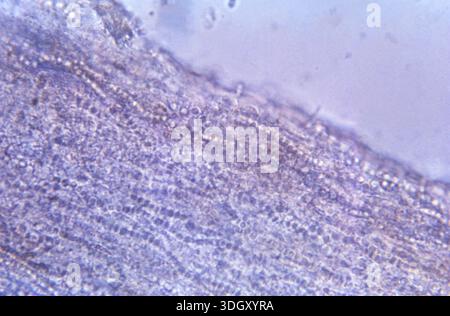 A 475X photomicrograph of a horse hair shaft shows histopathologic ...
