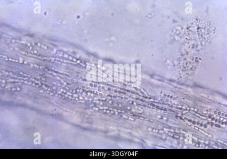A 475X photomicrograph of a horse hair shaft shows histopathologic ...