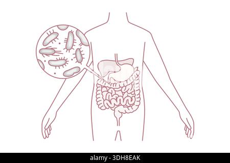 Digestive system and intestines concept. Human body with green and red bacterias microorganisms in stomach and intestines vector illustration Stock Vector