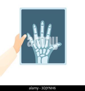 A doctor's hand in a white coat holds an X-ray of a hand against a white background. Concept for diagnosing bone problems and fractures. Stock Vector