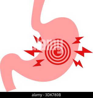 Gerd stomach icon in flat style. Reflux vector illustration on isolated ...