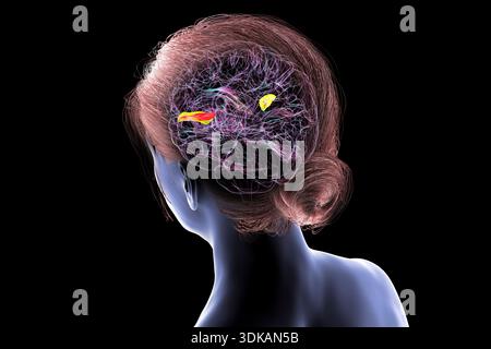 Illustration of the human brain with the transverse temporal gyri ...