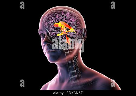 Ventricular system. Human brain with ventricles and Cerebrospinal fluid ...