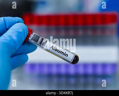 Blood sample tube for albumin test analysis Stock Photo - Alamy