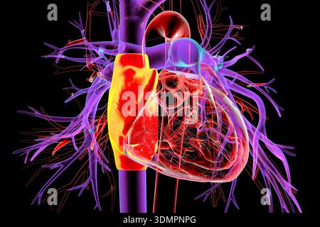 Atrium In Body Illustration of the heart with the right atrium highlighted in blue ...