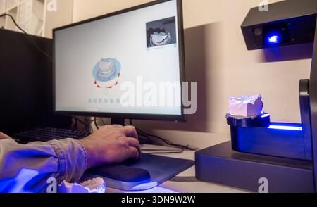 Dental lab worker scanning plaster dental mold using 3D scanner for CAD modeling, digital prosthetic design, and orthodontic planning in dental technology lab. Stock Photo