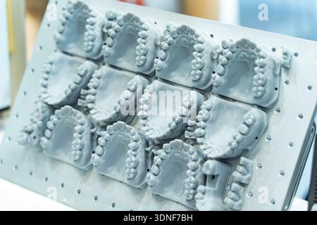 lower jaw of a man created on a 3d printer Stock Photo