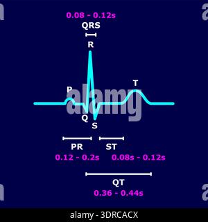 Normal ECG ( Electrocardiogram ) ( P wave , PR segment , PR interval ...