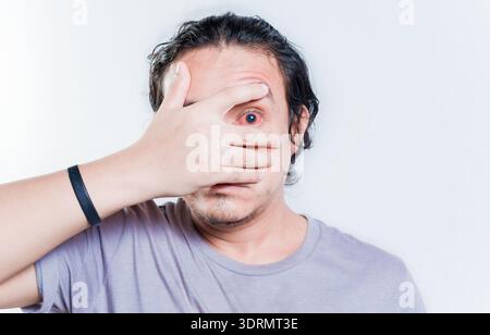 Young man with conjunctivitis isolated. People with irritated eye looking at camera isolated. Man with eye infection isolated Stock Photo