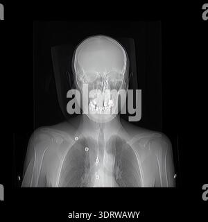 front view of a Patient undergoing CT scan showing detailed skeletal anatomy of head, neck and chest, transparent 3D view of brain, skull, spine, clav Stock Photo