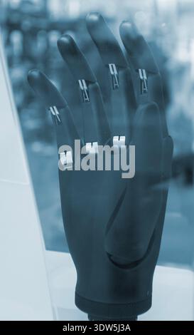 Bionic arm prosthesis. Plastic prosthesis printed on a 3D printer. Robotic arm. Robotics prosthesis for hand printed on a 3D printer from plastic powder. Modern new innovation medicine technologies. Stock Photo