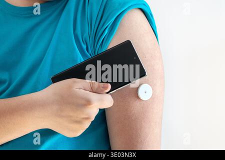 An overweight man checks his blood sugar level using a smartphone and a continuous glucose monitoring system. Stock Photo