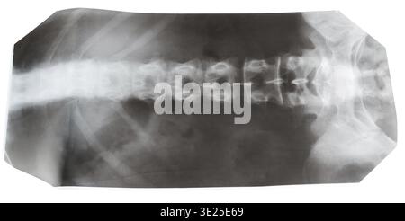X-ray picture of human spinal column isolated on white background Stock Photo