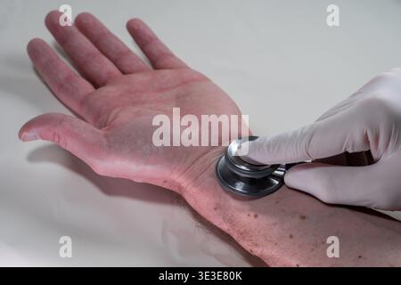 Dermatologist using dermatoscope on male hand wrist for skin cancer screening, close-up dermoscopy exam detecting melanoma early with gloved medical. Stock Photo