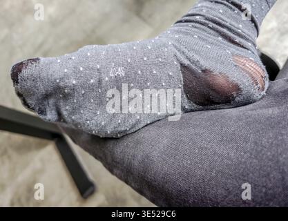 Worn-out sock on mans foot, close-up of damaged fabric and holes, everyday life detail showing clothing wear and tear and hygiene concept. Poor man Stock Photo