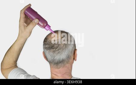 Mature man putting a hair conditioner in her hair. Man hair loss concept Stock Photo