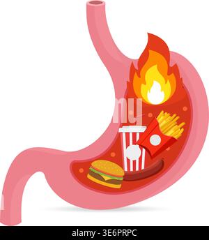 A human stomach filled with junk food and fire, representing indigestion, gastritis, and unhealthy eating habits. Stock illustration. Stock Vector