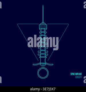 concept of spine implant or spine surgery, graphic of syringe combined with backbone Stock Vector