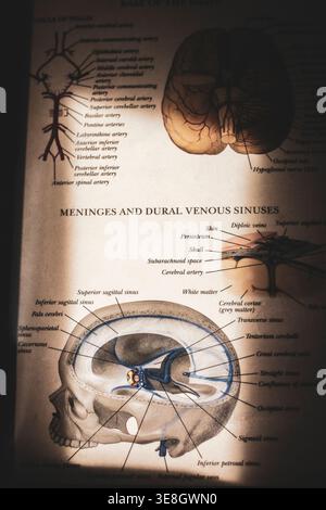 Medical diagram shows human brain anatomy. Skull cross-section highlights meninges and venous sinuses. Labels point to specific brain structures and v Stock Photo
