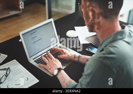 Man, hands and typing on laptop for article research, business or email communication in office. Journalist with vitiligo, tech or notes in agency for Stock Photo