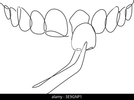 Ceramic veneers installation procedure for teeth silhouette drawing in linear style with thin black lines on white background Stock Vector
