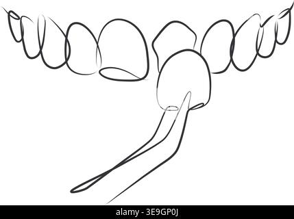 Ceramic veneers installation procedure for teeth silhouette drawing in linear style with black lines on white background Stock Vector