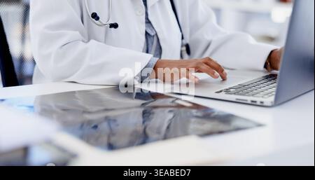 Hospital, typing and hands of doctor on laptop for online schedule, patient report and research. Healthcare, x ray and woman on computer for digital Stock Photo