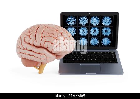 Brain Diagnostics And Neurological Imaging Concept. Human Brain Beside Laptop With Medical Brain Scan Display On White Background. 3D Rendering Stock Photo