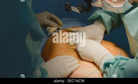 Close up males hands in protective gloves doing surgery operation. Two unrecognizable men doctors surgeons cutting skin with scalpel cut patient Stock Photo