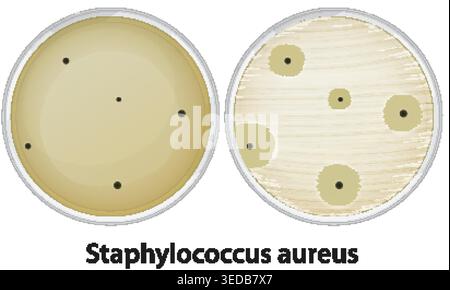 Scientific vector illustration of Staphylococcus aureus bacterial colonies and inhibition zones in laboratory petri dishes Stock Vector