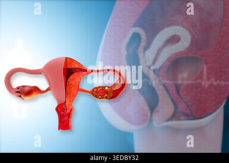Human uterus anatomy. 3d illustration Stock Photo