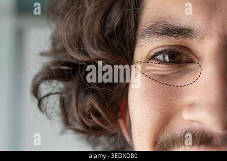 Man with dark circles and wrinkles under eye, a sign of aging or fatigue Stock Photo