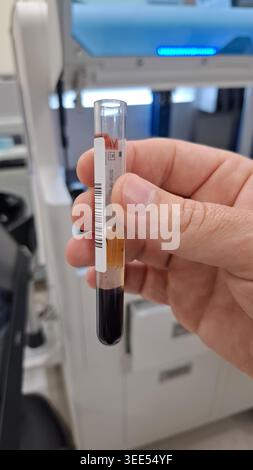 Centrifuged Blood Sample Close-up Stock Photo