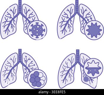 Colored Icons of Lung Disease, Bronchitis, COPD, and Pneumonia. Vector Icons of Various Lung Diseases. Healthcare and Medicine Stock Vector