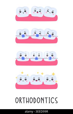 Set of cute shaded cartoon tooth characters showing orthodontic treatment stages with orthodontics text on white background vector illustration Stock Vector