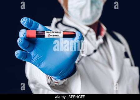 Healthcare worker holds hantavirus positive blood sample in laboratory setting Stock Photo