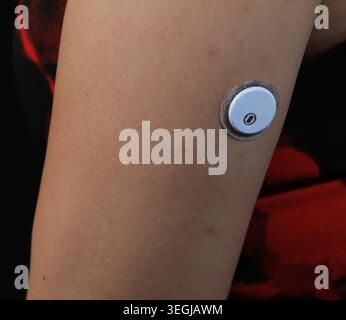 Close Up of Woman Wearing Continuous Glucose Monitor CGM Sensor on Arm for Diabetes Tracking Stock Photo