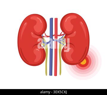Kidney pain anatomy. Medical concept for disease diagnosis. Vector illustration in flat cartoon style Stock Vector